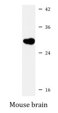 Anti-Neutrophil Elastase