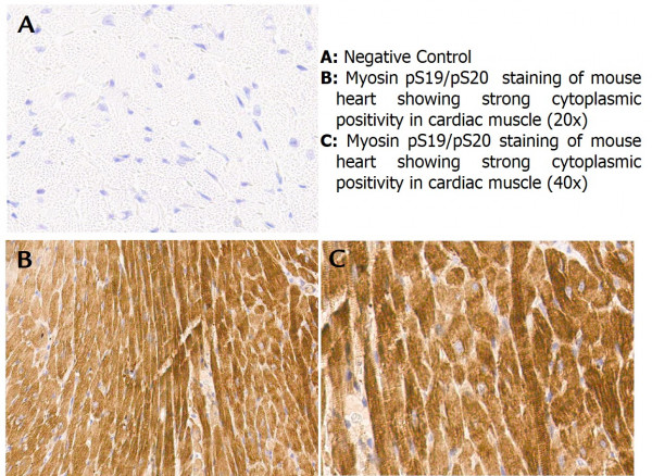Anti-phospho-Myosin (Ser19/Ser20)