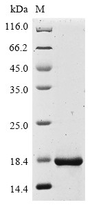 Protein IL-40 (C17orf99), partial, human, recombinant