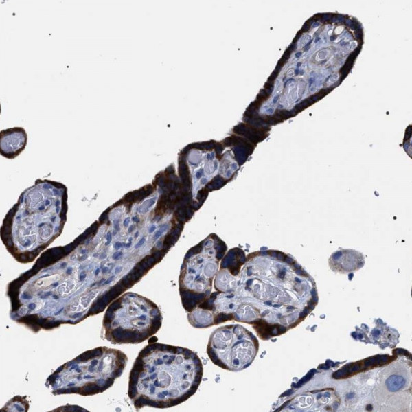 Anti-SVEP1