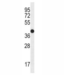 Anti-CD271