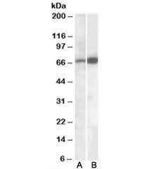 Anti-CADM4