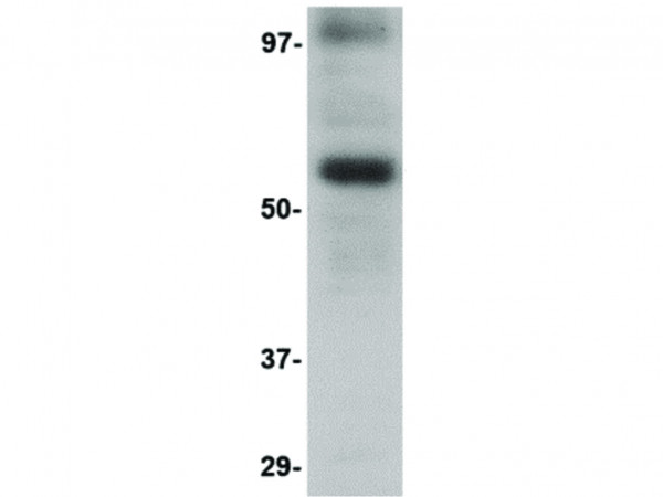 Anti-LGI3