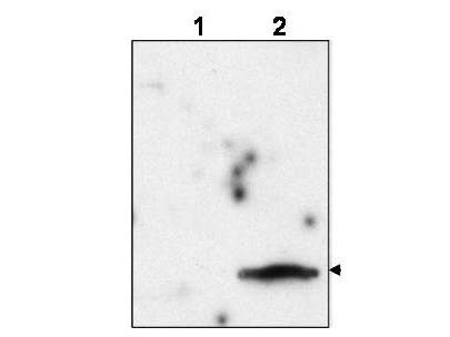 Anti-Feline Immunodeficiency Virus Matrix Protein p15