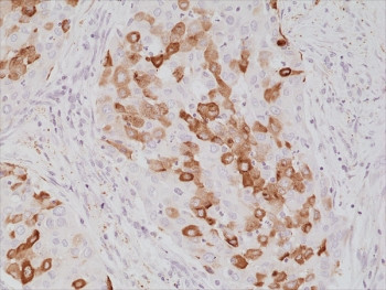 Anti-Surfactant protein A / SFTPA1 (recombinant antibody), clone RM334