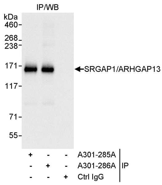 Anti-SRGAP1/ARHGAP13