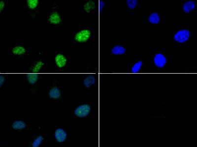 Anti-phospho-Histone H3 (p Thr6)Antibod