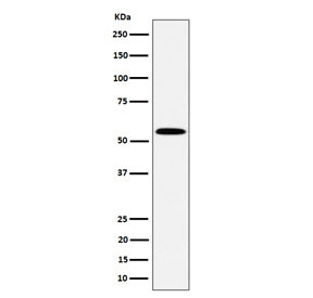 Anti-PNKP / Polynucleotide kinase-3'-phosphatase, clone 29P36