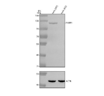 Anti-PARP1 / Poly ADP-ribose polymerase 1