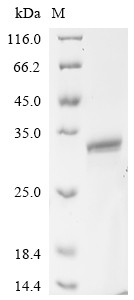 Heme-binding protein 1 (Hebp1), mouse, recombinant