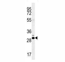 Anti-CT45A