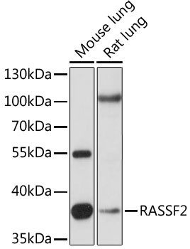 Anti-RASSF2 [Rabbit] (CAB15767)
