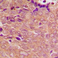 Anti-PSMC3 / TBP1
