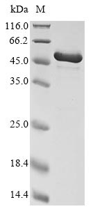 Calreticulin (CALR), Cricetulus griseus, recombinant
