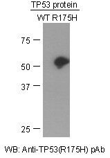 Anti-TP53 (R175H)