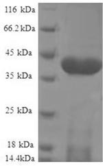 NADH dehydrogenase [ubiquinone] iron-sulfur protein 5 (NDUFS5), human, recombinant