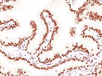 Anti-Androgen Receptor Cocktail, clone AR441 + DHTR/882