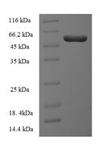 Integrin-linked kinase-associated serine/threonine phosphatase 2C (ILKAP), human, recombinant