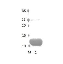 SYNP2 PDZ Domain