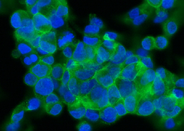 Anti-ASGR2/ASGPR2 Monoclonal Recombinant Antibody