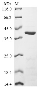 HLA class I histocompatibility antigen,B alpha chain (HLA-B), partial, human, recombinant