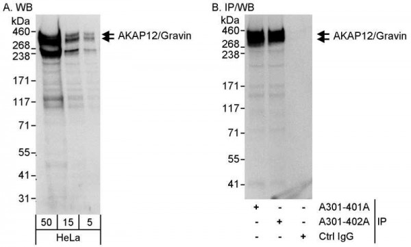 Anti-AKAP12/Gravin