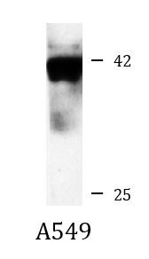 Anti-PRMT1, clone 4E9-H9-H12