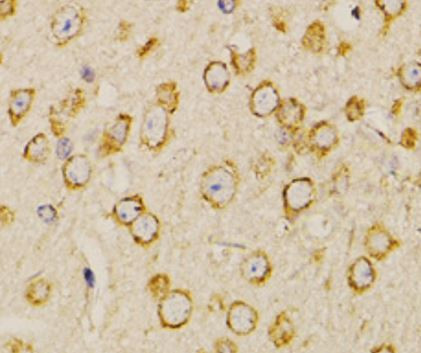 Anti-Neurotensin / Neuromedin-N Precursor