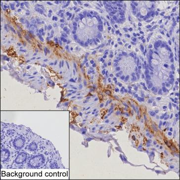 Anti-TGM2