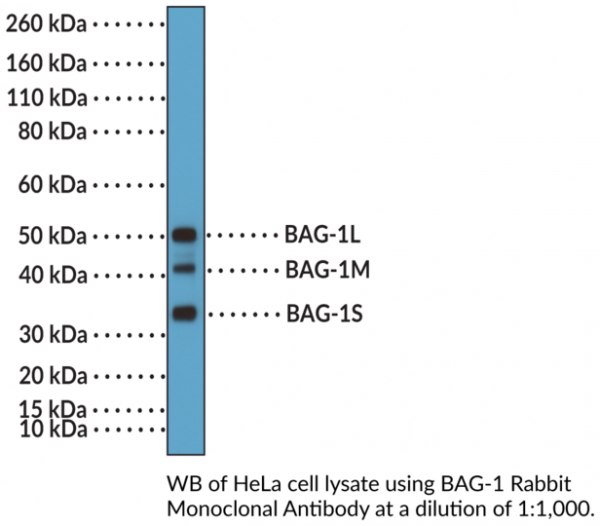 Anti-BAG-1 Rabbit Monoclonal Antibody (Clone RM356)