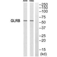 Anti-GLRB