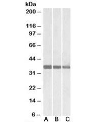 Anti-MDH1