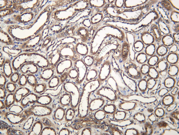 Anti-Recombinant DAP 1, clone C112513