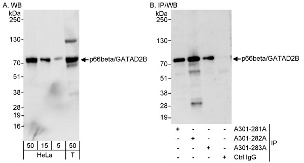 Anti-p66beta/GATAD2B
