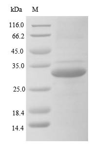 Ficolin-3 (FCN3), human, recombinant