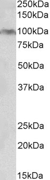 Anti-Aryl Hydrocarbon Receptor