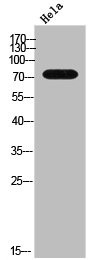 Anti-ADRBK1