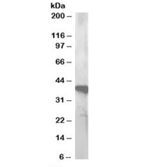 Anti-GIPC3