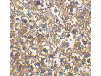 Anti-IRAKM (IL-1 Receptor-associated Kinase)