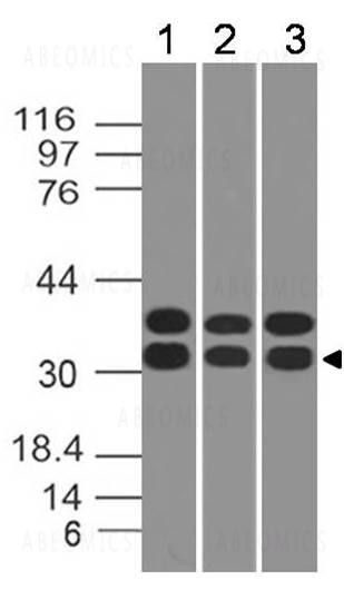 Anti-Caspase-3 (Clone: ABM11D3)
