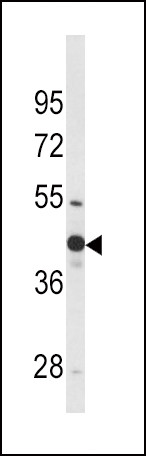 Anti-Wnt4