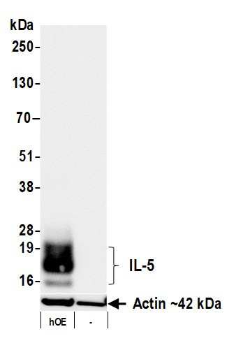 Anti-IL-5 Recombinant Monoclonal