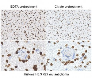 Anti-Histone H3 K27M (human), Rabbit Monoclonal (RM192)