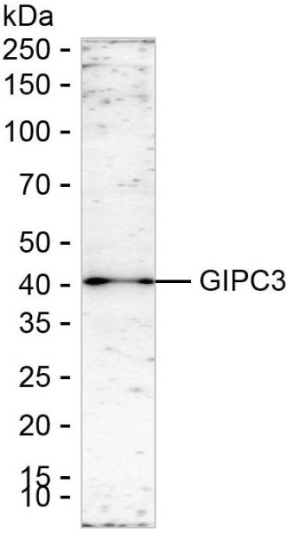 Anti-GIPC3
