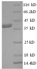 Mast cell carboxypeptidase A (CPA3), human, recombinant