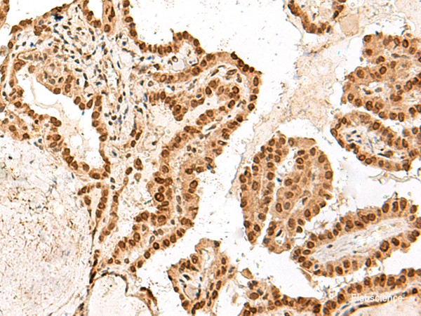 Anti-ARMC8