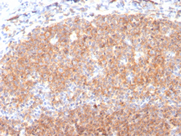 Anti-CD19 (B-Lymphocyte Marker), clone CD19/3117