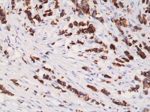 Anti-Cytokeratin-19 (human), Rabbit Monoclonal (RM364)