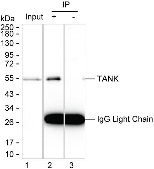 Anti-TANK Magnetic Beads