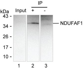Anti-NDUFAF1